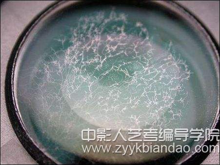 鏡頭發霉